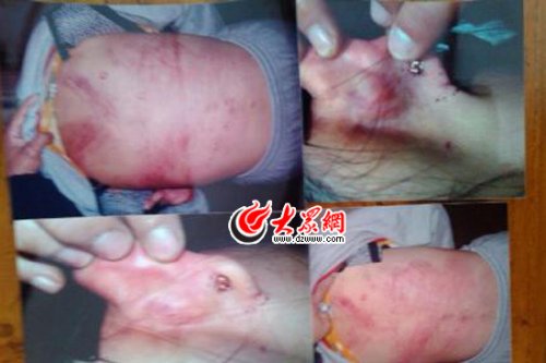 　山東藝術(shù)設(shè)計(jì)學(xué)院16歲女生宿舍內(nèi)被女同學(xué)暴打4小時(shí)。