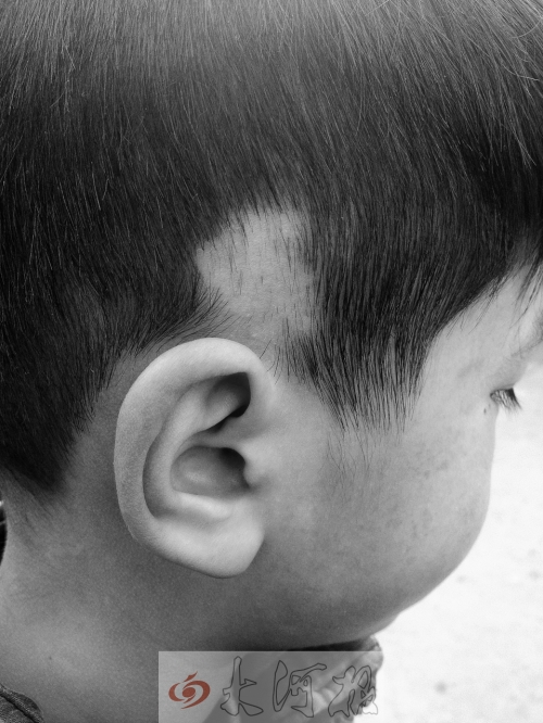 班主任下手10歲男生變“禿頭” 班主任下手10歲男生變“禿頭”