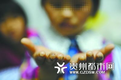 指尖被針扎得傷痕累累。