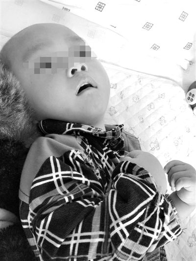 9月10日，陳揚(yáng)躺在醫(yī)院的病床上，他的眼睛仍然沒(méi)有聚焦感。新京報(bào)記者 朱柳笛 攝