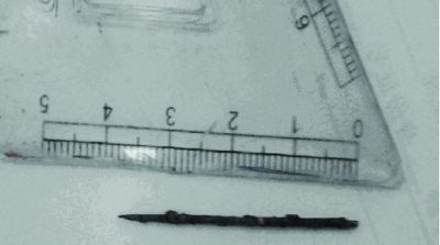 取出的繡花針已發(fā)黑生銹。