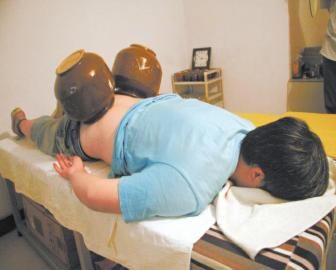 拔泡菜壇子火罐。