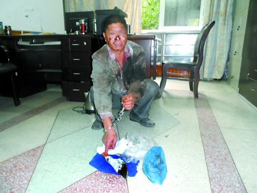   目前張遠已被刑事拘留。