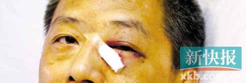 ■這起醫(yī)鬧事件，受傷的遠(yuǎn)遠(yuǎn)不只是熊旭明醫(yī)生的身體。