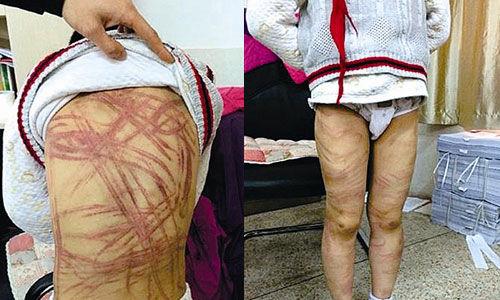 南京虐童案養(yǎng)母致歉:將用加倍關愛彌補過失 南京虐童案養(yǎng)母致歉:將用加倍關愛彌補過失