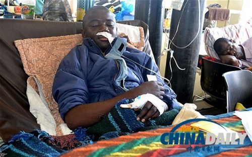 雖然已經(jīng)在醫(yī)院接受了近一個(gè)月的恢復(fù)治療，卡托卡的身體仍然非常虛弱。