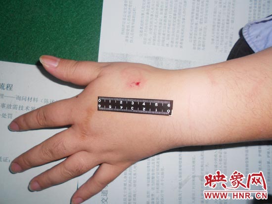 為幫助無證駕駛的朋友逃避處罰，新鄉(xiāng)的王某竟對執(zhí)勤民警大打出手，還將一名民警的手臂咬傷