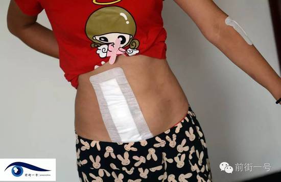 小金腹部的傷口。