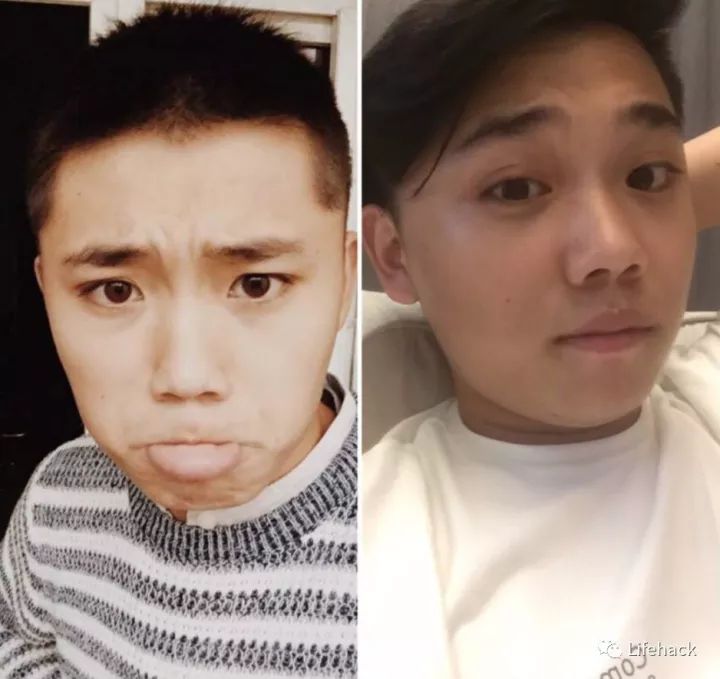 長胖20斤，臉型怎么變？這些例子看完扎心了！