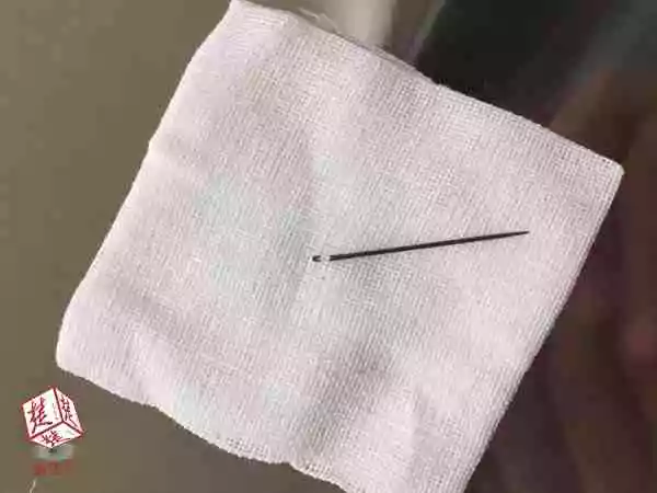 7歲男童將3厘米繡花針塞進尿道 數家醫(yī)院束手無策