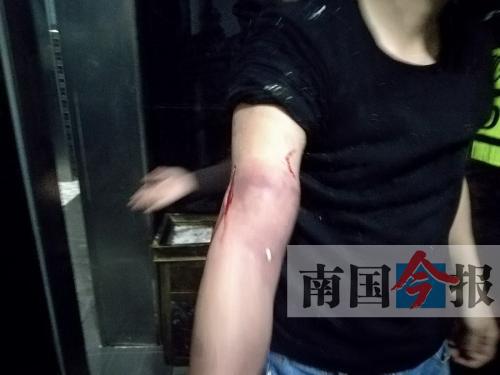 覃先生手臂被卡的部位受傷流血，所幸傷勢(shì)無(wú)大礙。 通訊員 王建民 攝