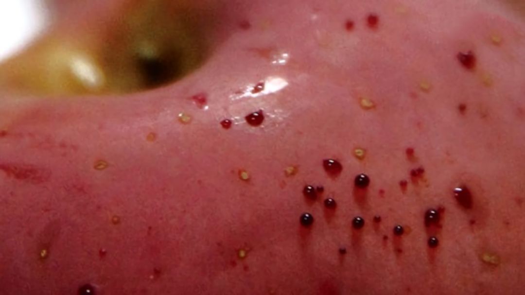 嚇懵！女子用熱水泡蘋果結(jié)果冒出血珠 咋回事？