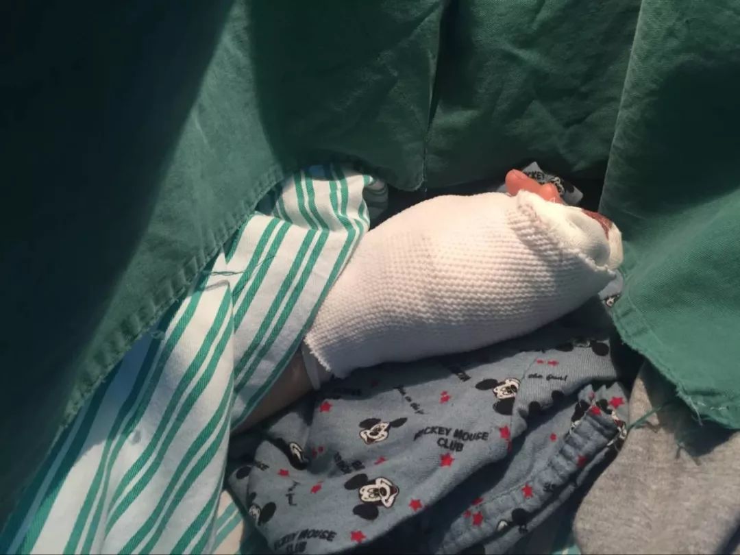 嚇哭！6歲男孩被夾斷手指 罪魁禍首竟是校服