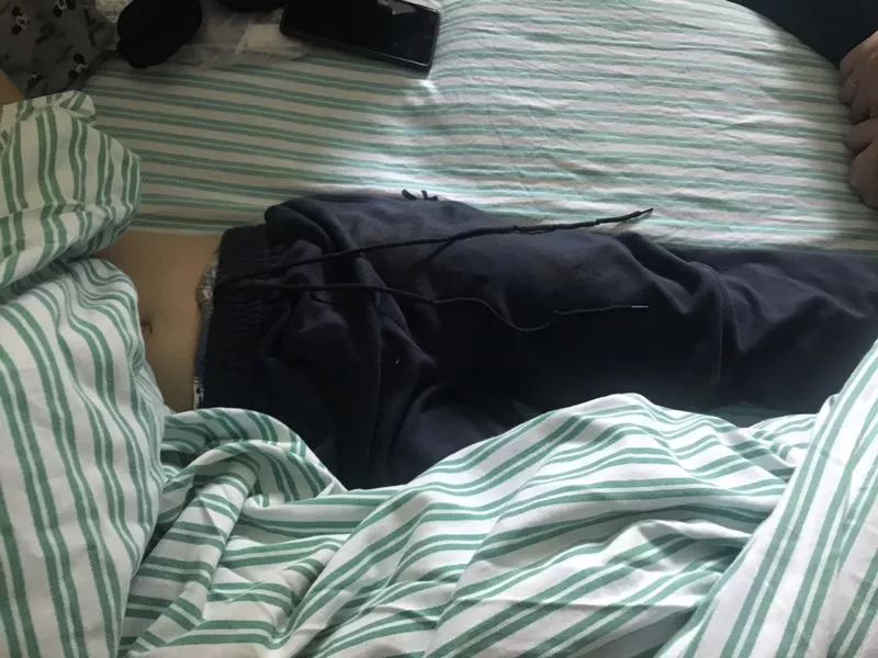 嚇哭！6歲男孩被夾斷手指 罪魁禍首竟是校服