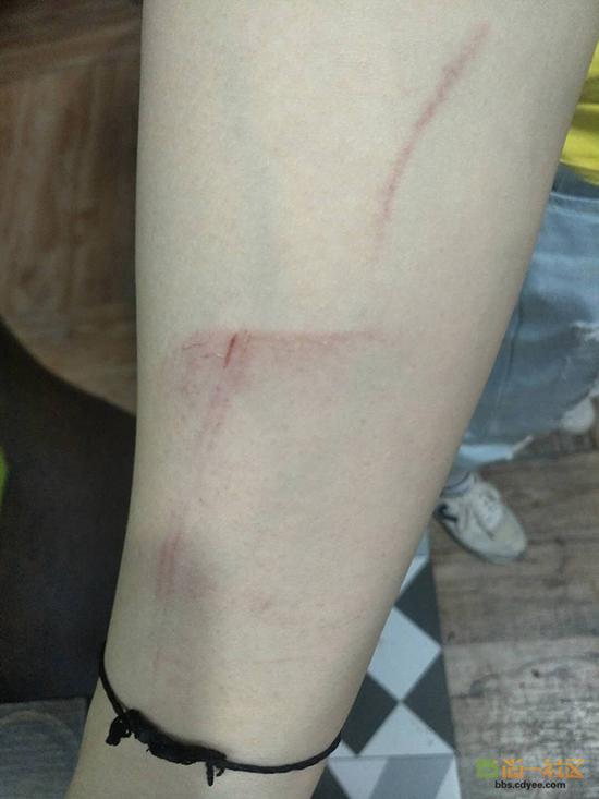 女網(wǎng)友舉報網(wǎng)帖中出示的被打后照片。