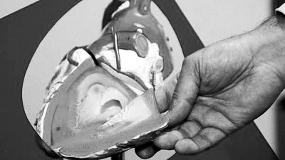 威廉斯領導的研究團隊已經利用人體脂肪干細胞，成功3D打印出心臟血管和心臟瓣膜，待一顆心臟的所有部件打