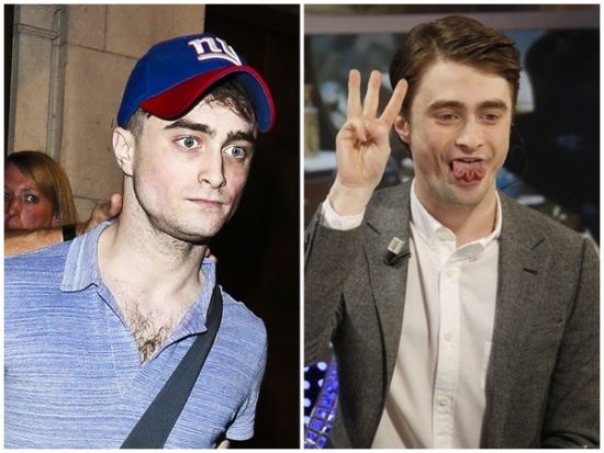 丹尼爾日前被拍到骨瘦如柴，不似2月份健康