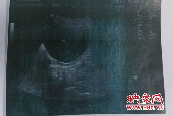 鄭州大學(xué)第三附屬醫(yī)院鑒定 鄭州大學(xué)第三附屬醫(yī)院鑒定