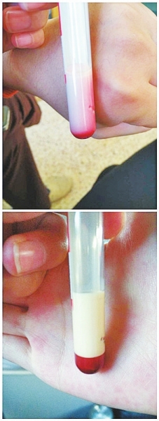 信陽嬰兒患怪病血液呈乳白色 求助權威機構查病因遭拒 信陽嬰兒患怪病血液呈乳白色 求助權威機構查病因遭拒