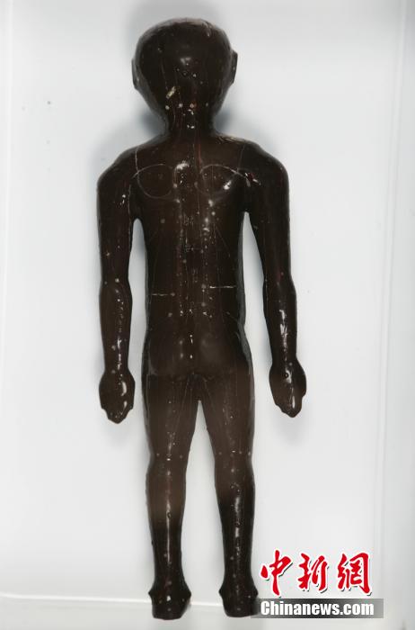 圖為出土的人體經(jīng)穴漆俑。