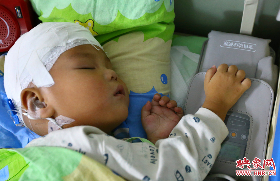 經(jīng)過(guò)手術(shù)，小龍病情已經(jīng)逐漸好轉(zhuǎn)，正在甜甜的熟睡