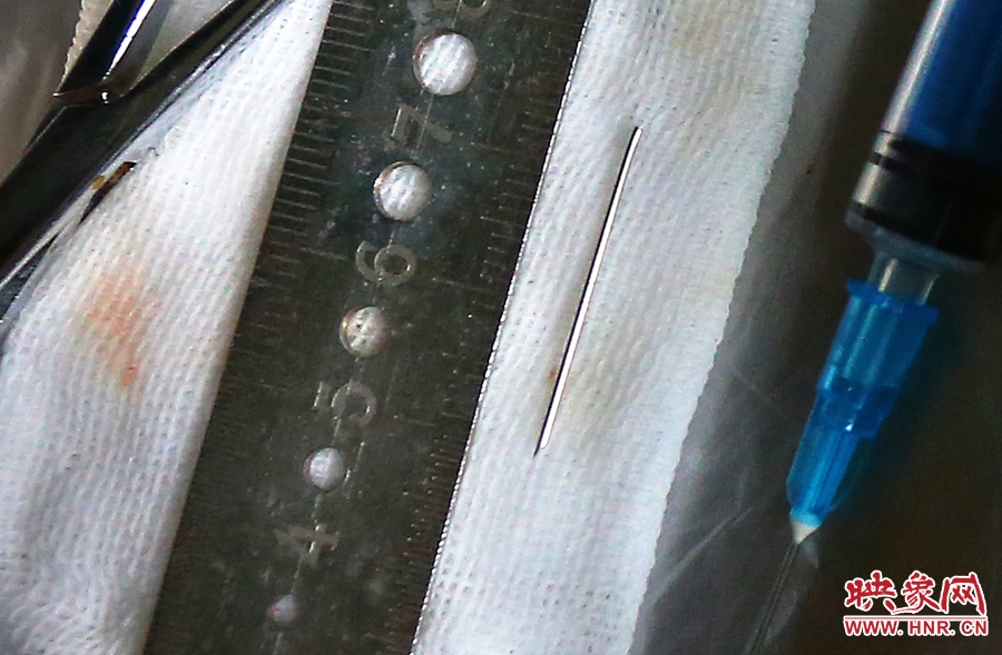 上午11點(diǎn)42分，大龍顱內(nèi)的鋼針被取出