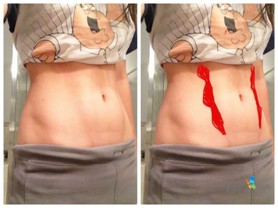 蔡依林 你的馬甲線“脫妝”了！