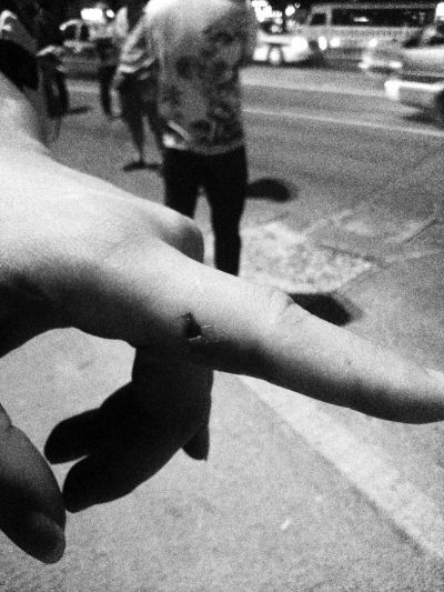 民警食指被咬傷。