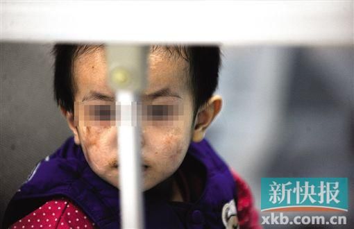 去年3月就能出院的小華(化名),目前還在廣州市婦兒醫(yī)療中心的PICU里住著。新快報(bào)記者 孫毅/攝