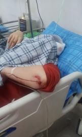 砸窗當(dāng)事人胡女士在醫(yī)院接受治療。