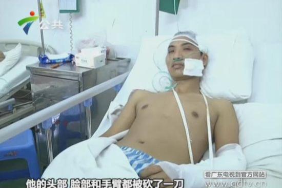 另一名傷者頭部、臉部和手臂都被砍了一刀。(視頻截圖)