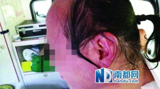 涉事教師遭熱水潑臉后的照片。