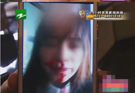 24歲女大學生被包養(yǎng) 意外懷孕遭對方帶人圍毆 24歲女大學生被包養(yǎng) 意外懷孕遭對方帶人圍毆