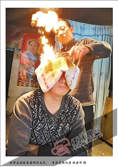 民間高人用火療治頑固性頭痛 圍觀者尖叫(圖) 民間高人用火療治頑固性頭痛 圍觀者尖叫(圖)