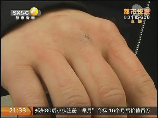 說到這足療拔罐，估計(jì)大伙都不陌生，但是想起4號(hào)晚上的拔罐的經(jīng)歷，呂先生現(xiàn)在想起來，還心有余悸。