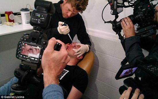 該實驗是由加州一支名為“生物駭客”的實驗團隊開展的。他們使用了一種名為二氫卟吩e6（Ce6）的物質(zhì)的溶液。Ce6常見于深海魚體內(nèi)，有光敏特性，通常用于癌癥治療研究中。研究團隊將Ce6與胰島素和鹽水混合起來，得到一種溶液，可以在低光照條件下提高人類的視力。