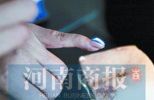 將指甲油涂在指甲上，靠近火焰時被引燃了