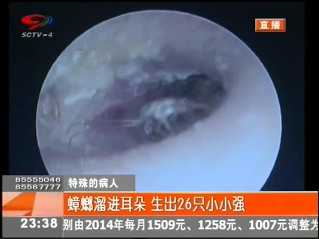 小強溜進耳朵？生26只小小強