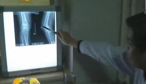 冷空氣來襲 如何預(yù)防老寒腿？