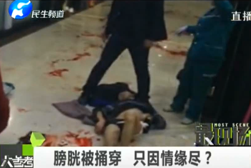 膀胱被捅穿 只因情緣盡？